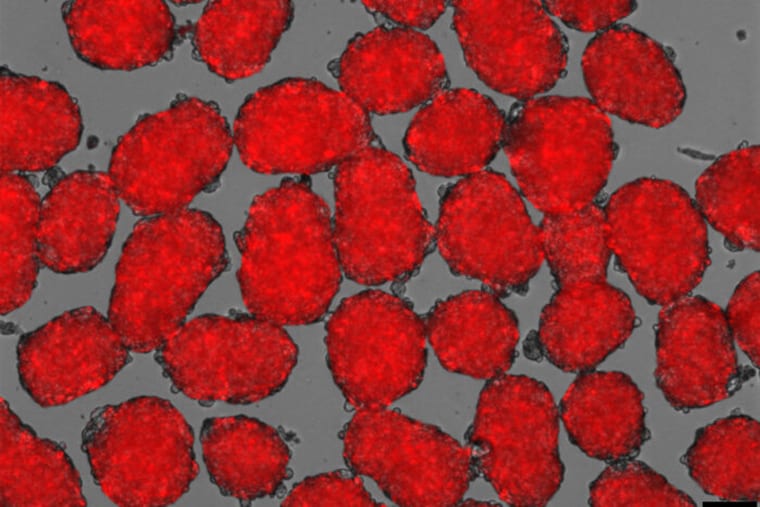 New protocol leads to better stem cell-derived pancreatic B-cells